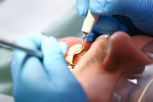 Best Emergency Root Canal Treatment in Temple Hills, MD