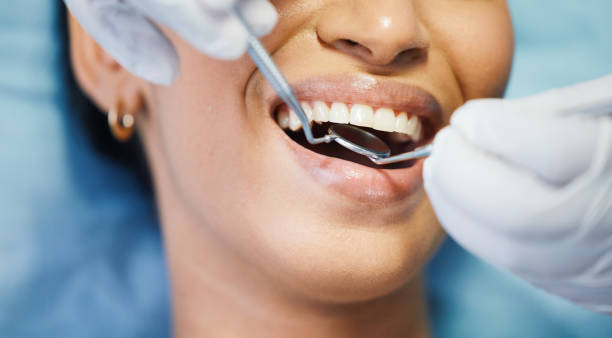 Best Pediatric Emergency Dentist in Temple Hills, MD